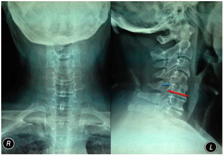 Fig. 2