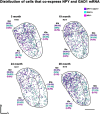 Cell distribution diagrams showing co-expression of NPY and GAD1 mRNA at 3, 19, 24, and 28 months. Each panel displays clusters of colored dots: purple for NPY+/GAD1+, blue for GAD1+, and pink for NPY+. Regions ICd, IClc, and ICc are labeled with percentages of each expression type. A scale bar and directional markers are included.