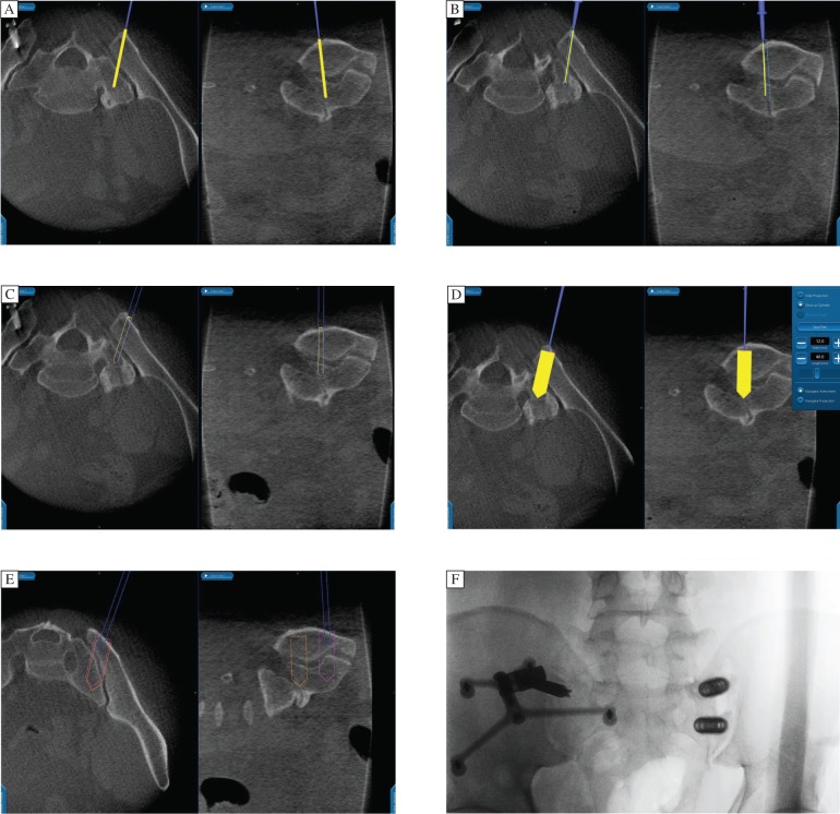 Fig. 2