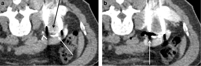 Figure 12.