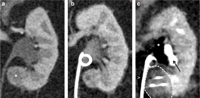 Figure 11.