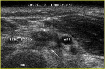 Figure 20