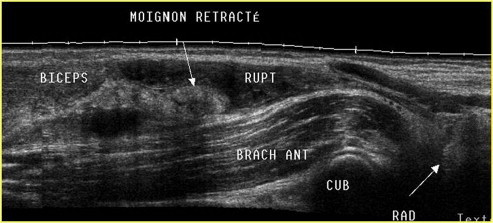 Figure 21