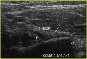 Figure 24