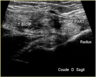 Figure 22