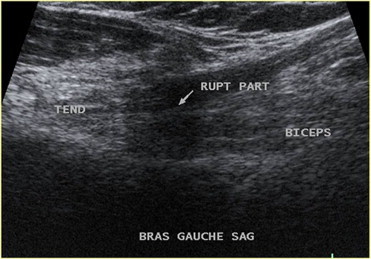 Figure 16