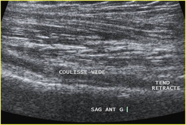 Figure 13