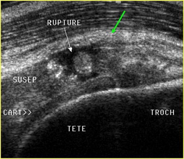 Figure 4