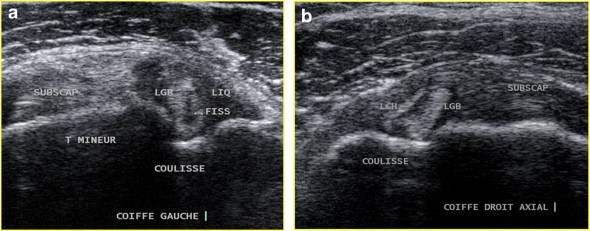 Figure 11