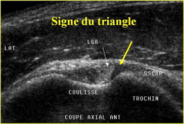 Figure 6