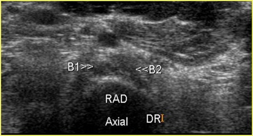 Figure 19