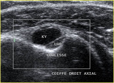 Figure 10