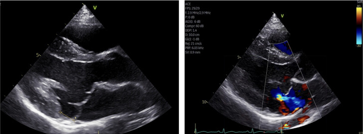 Figure 4