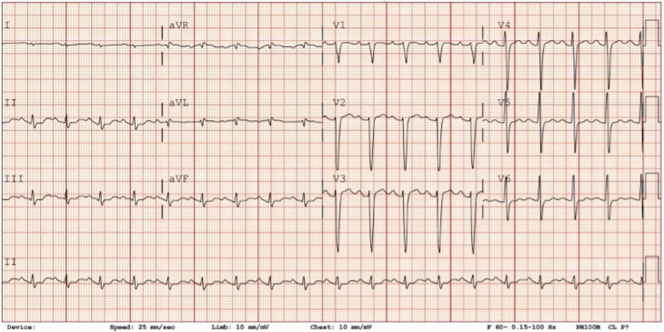 Figure 1