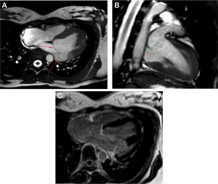 Figure 2