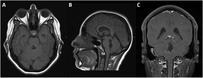 Fig. 1