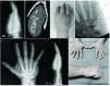Fig. (1)
