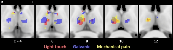 Fig. 5
