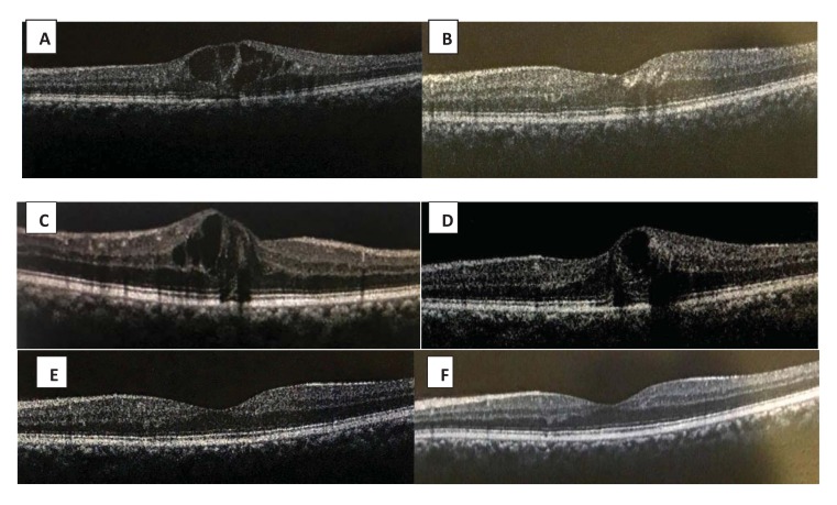 Fig. (1)