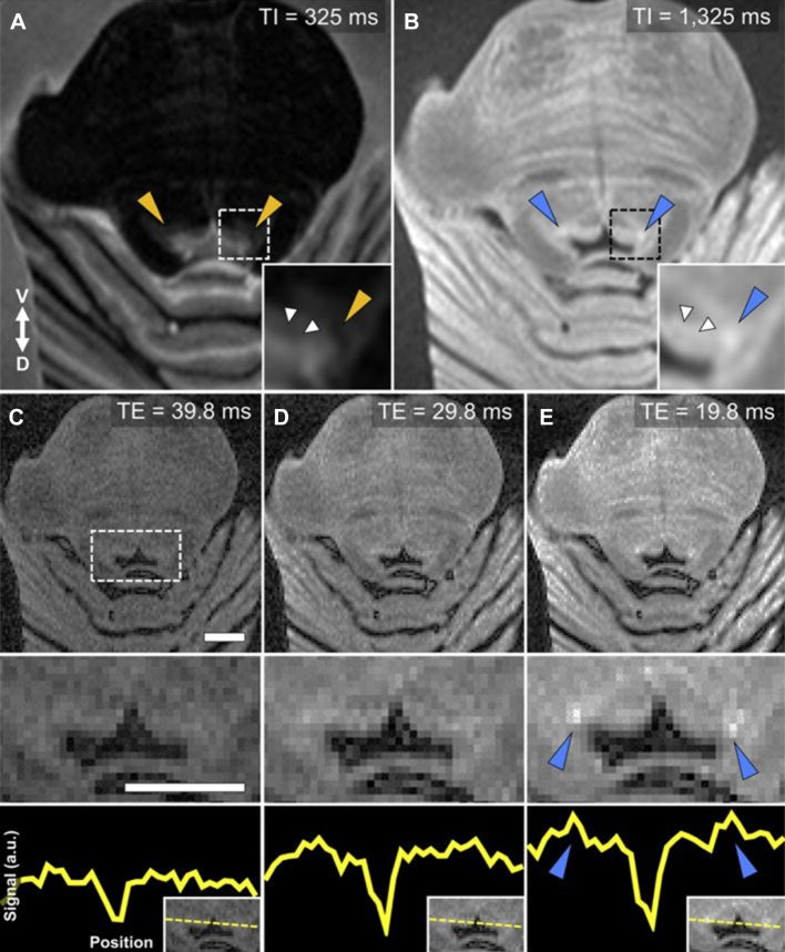 Fig. 4