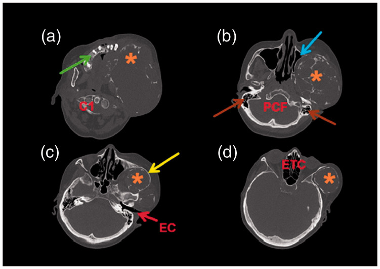 Figure 3.