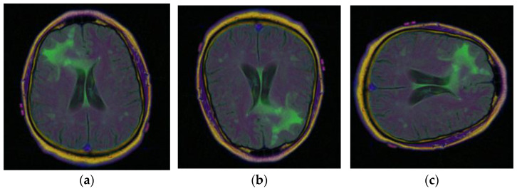 Figure 6