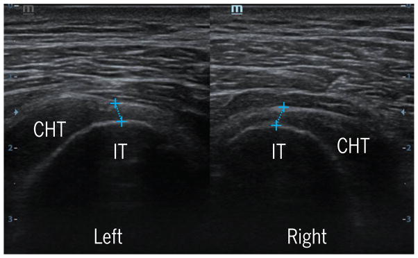 FIGURE 3