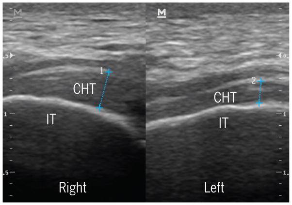 FIGURE 1