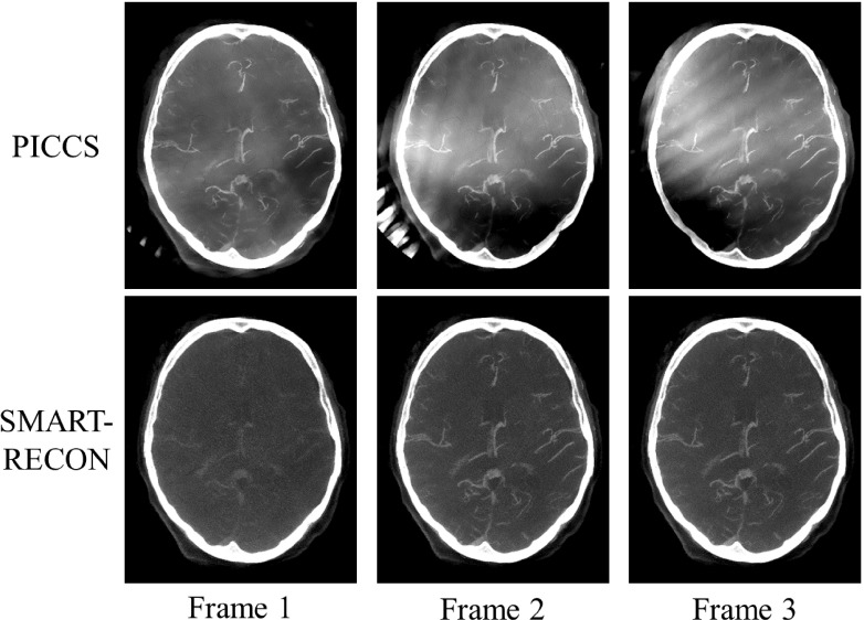 FIG. 5.