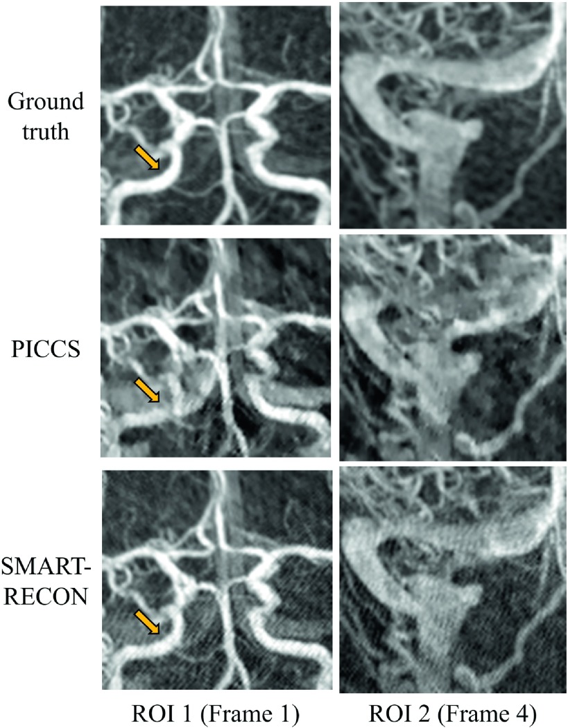 FIG. 2.