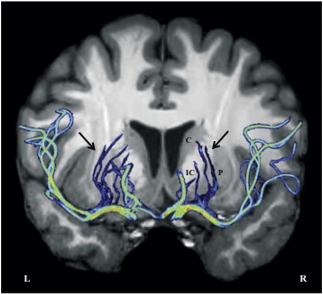 Fig. 2