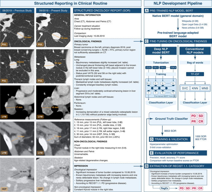 Structured oncologic assessment in clinical routine and natural language processing (NLP) model building. An exemplary structured oncology report (SOR) for a 32-year-old woman with a history of breast cancer (left side) was interpreted as progressive disease (PD). The oncologic data were automatically processed and then fed into the NLP development pipeline (right side, A–E). (A) The deep NLP architecture used was based on the bidirectional encoder representations from transformers (BERT) language model pretrained on unlabeled general domain data and adapted to the German vocabulary. (B) Automatic extraction of the Response Evaluation Criteria in Solid Tumors (RECIST)–related categories PD, stable disease (SD), partial response (PR), and complete response (CR) from the SOR “impression” section by using a rule-based pattern-matching command called regular expressions (RegEx). (C) Fine-tuning of BERT and three feature-rich NLP methods (linear support vector classifier [SVC], k-nearest neighbors [KNN], multinomial naive Bayes [MNB]) on the extracted SOR oncologic findings section. The output of (B) was used as ground truth classifier for (D) NLP model training and validation, followed by (E) performance evaluation on the free-text oncology reports (FTOR) test sets in comparison with human baseline scores. A live demo of the SOR template can be accessed for review at http://www.targetedreporting.com/sor/. For demonstration purposes, the presented exemplary SOR and the online template have been translated from German to English. TF-IDF = term frequency–inverse document frequency.