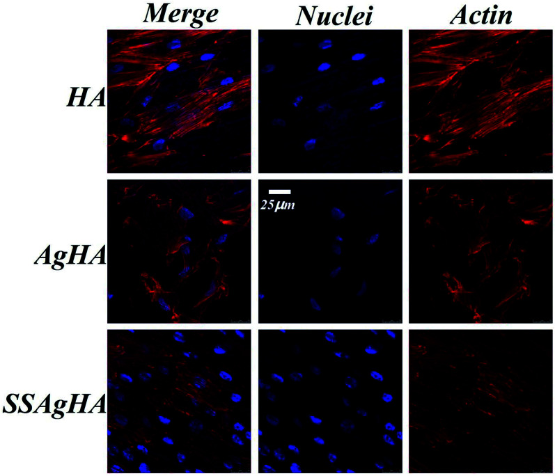 Fig. 12