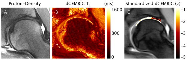 Figure 11