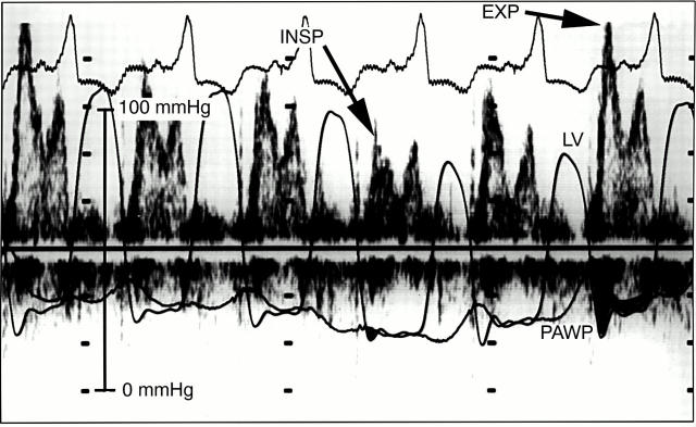 Figure 1  