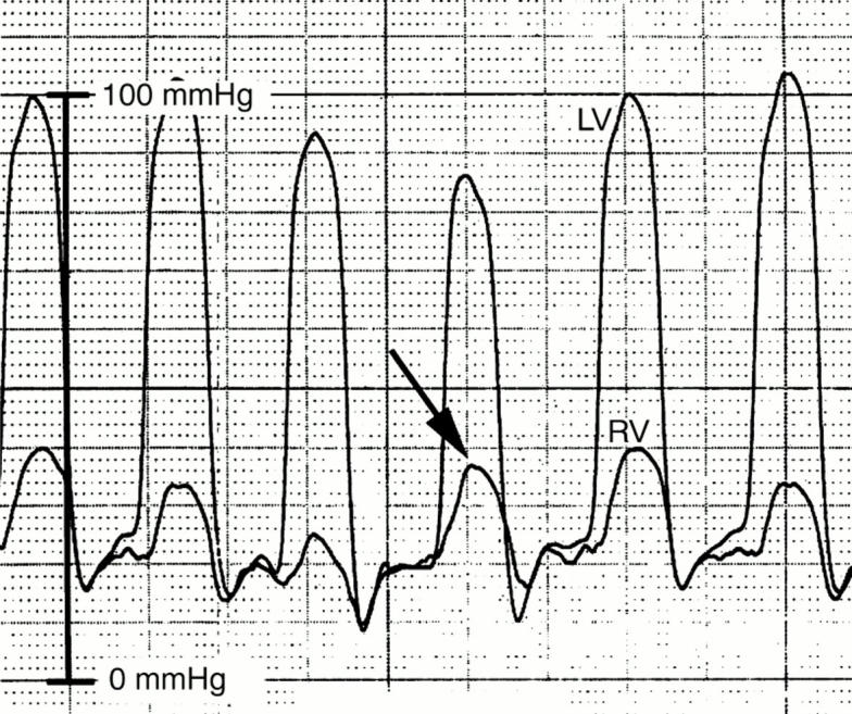 Figure 4  