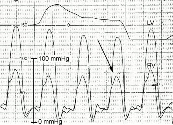 Figure 5  