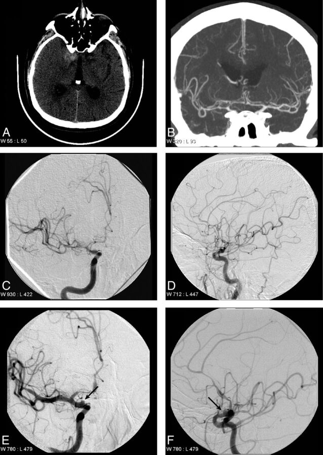 Fig 3.