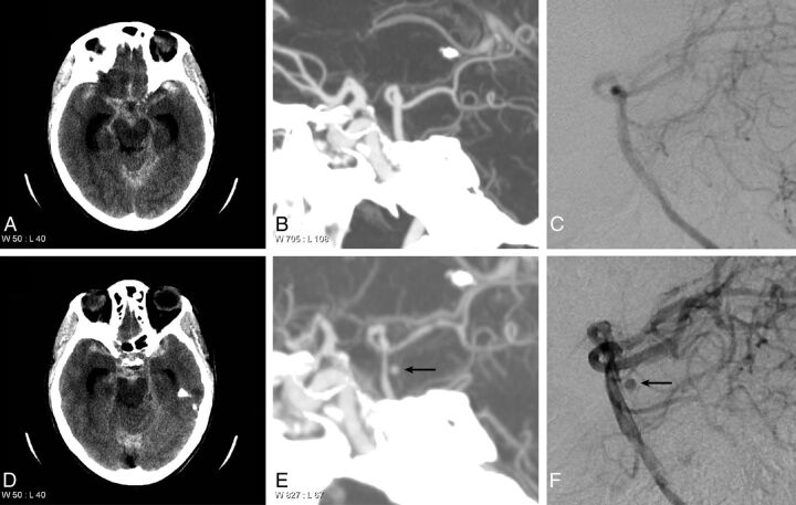 Fig 4.