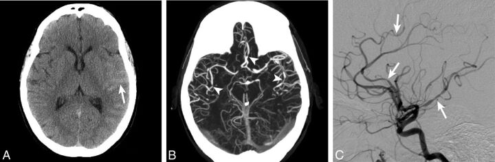 Fig 2.