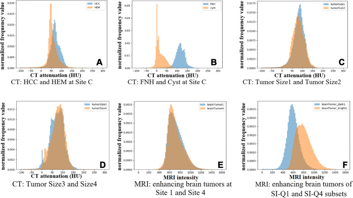 Examples of histograms between two different subsets of tumors in CT Liver Tumor Segmentation and MRI brain tumor segmentation datasets. (A) CT: HCC and HEM at site C (arterial phase): EMD = 3.3443, BD = 0.0699, CSD = 0.1278, KSD = 0.28. (B) CT: FNH and cyst at site C (arterial phase): EMD = 23.7903, BD = 1.4561, CSD = 0.9029, KSD = 0.48. (C) CT: tumor size 1 (≤15 cm3) and size 2 (15EN_DASH50 cm3) (PV phase): EMD = 0.9238, BD = 0.0071, CSD = 0.0139, KSD = 0.11. (D) CT: tumor size 3 (50–130 cm3) and size 4 (>130 cm3) (PV phase): EMD = 0.7824, BD = 0.0114, CSD = 0.0217, KSD = 0.09. (E) MRI: enhancing brain tumors at site 1 and site 4: EMD = 0.5425, BD = 0.0022, CSD = 0.0042, KSD = 0.14. (F) MRI: enhancing brain tumors of SI-Q1 and SI-Q4 subsets: EMD = 12.8243, BD = 0.3104, CSD = 0.3939, KSD = 0.30. BD = Bhattacharyya distance, CSD = χ2 distance, EMD = earth mover’s distance, FNH = focal nodular hyperplasia, HCC = hepatocellular carcinoma, HEM = hemangioma, KSD = d statistic of Kolmogorov-Smirnov test, Q = quarter, SI = signal intensity.