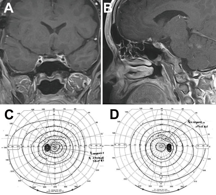 Fig. 4