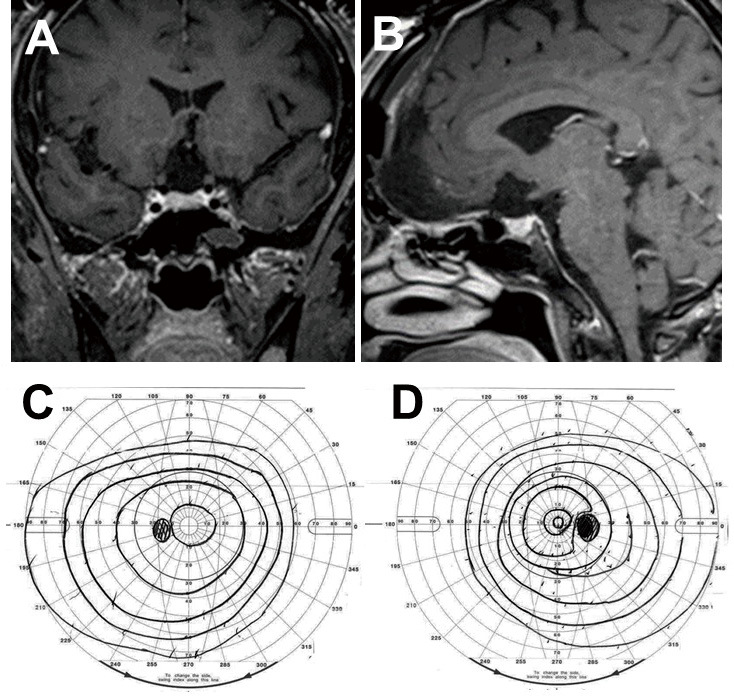 Fig. 2