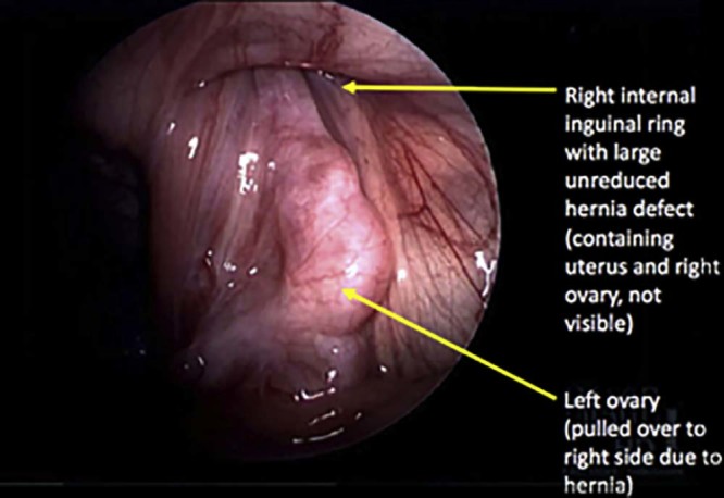 Fig. 4