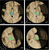 Fig 8