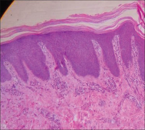 Figure 5b
