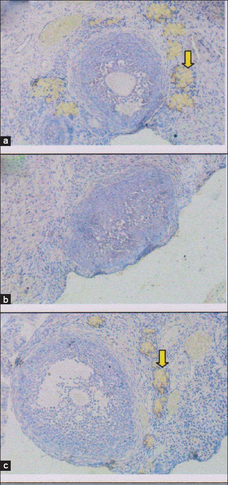 Figure-3