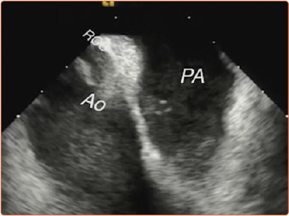 Figure 2: