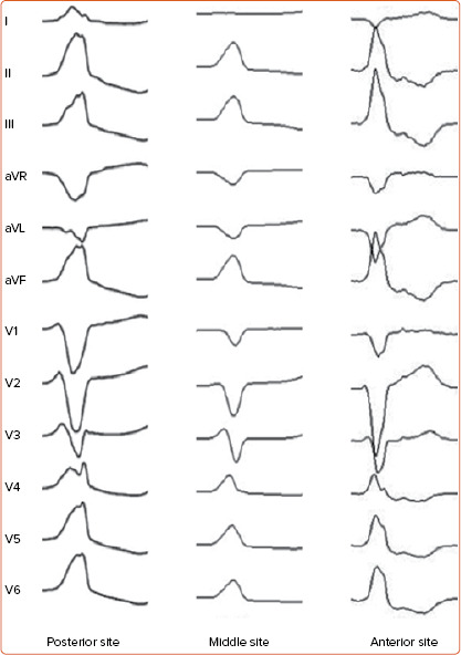 Figure 3: