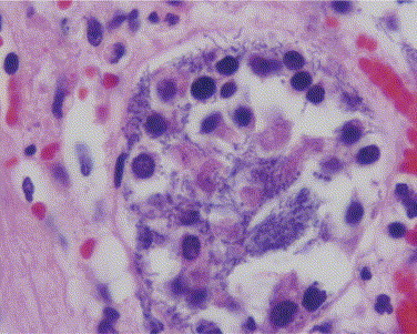 Figure 15-12